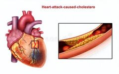 5 Herbs for Activating Blood Circulation, Resolving Stasis, Alleviating Pain, and Improving Chest Tightness, Precordial Pain, Dizziness, and Headaches