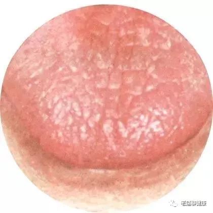 Learn Quick Ways to Observe Tongue Quality and Coating to Understand Your Health and Diseases!