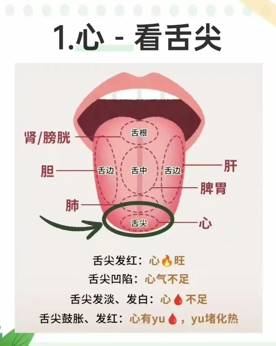 Tongue Diagnosis and the Five Organs