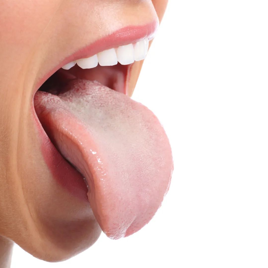 The Tongue as a Reflection of Health: A Quick Self-Check!