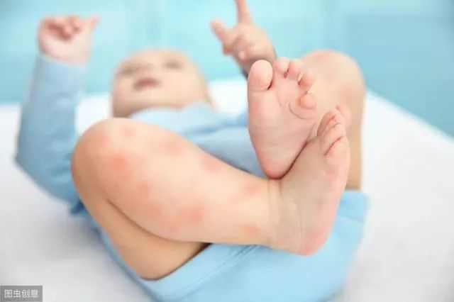 Damp-Heat: The Root of Many Illnesses! Eczema, Jaundice, Diabetes, and Gynecological Inflammation All Bear Its Shadow