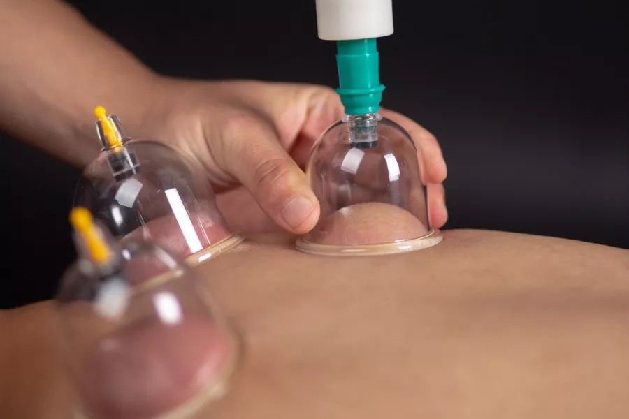 Definition and Functions of Bloodletting in Traditional Chinese Medicine
