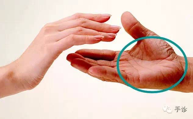 Eight Principles of Hand Diagnosis Based on Color Observation (Must-Collect)