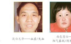Diagnosis in Traditional Chinese Medicine