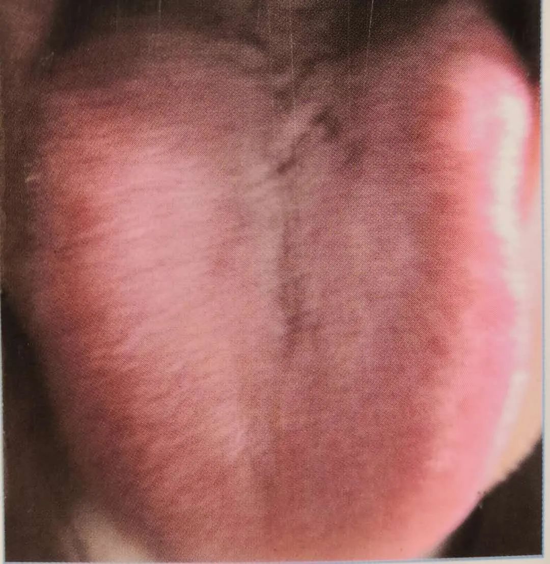 Inheritance of Traditional Chinese Medicine at Zhigu Tang | Basic Theory of TCM Lesson 34 (Tongue Diagnosis: Tongue Color)