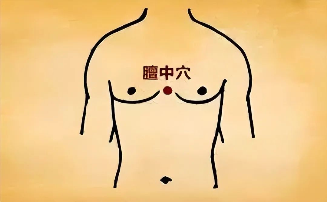 Luo Dalun: Liver Qi Stagnation Can Be Treated with Cupping