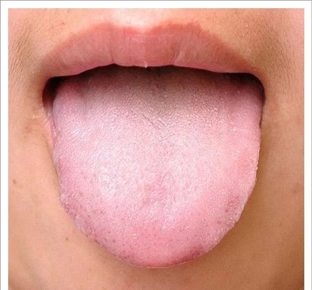 Traditional Chinese Medicine Tongue Diagnosis: 26 Clinical High-Definition Tongue Diagnosis Images with Analysis