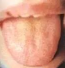 Comprehensive Guide to Tongue Diagnosis: Easily Understand Your Health Condition