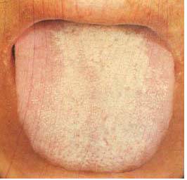 62 High-Definition Tongue Diagnosis Charts with Illustrations (Collector's Edition)