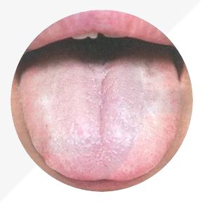Analysis of High-Definition Tongue Diagnosis Charts: Understanding Health Through Your Tongue (Part 1)