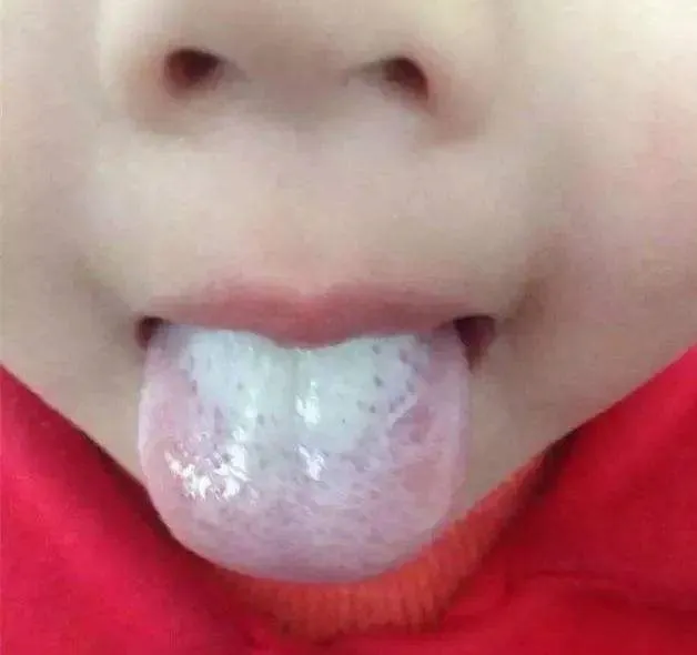 When Your Tongue Shows This Signal: Go to the Hospital Immediately, Don't Delay!
