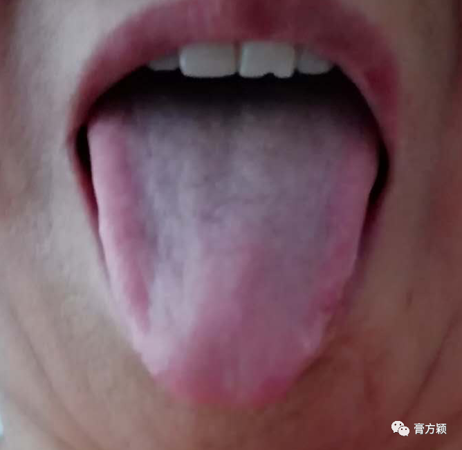The Health Code Hidden on Your Tongue