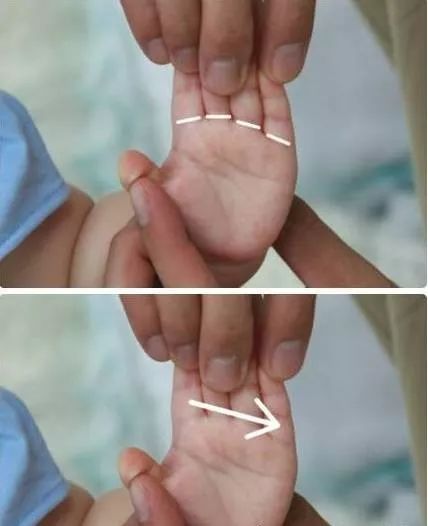 21 Pediatric Tuina Techniques to Easily Address Common Childhood Ailments!