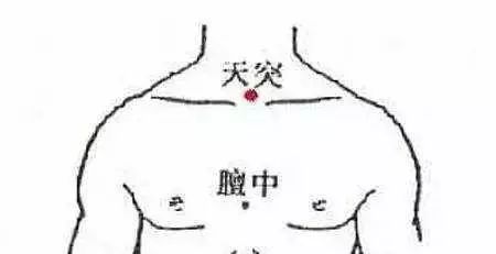 Chen Xuedong Shares His Gua Sha Experience: Experts Warn Against Incorrect Techniques That May Harm Kidney Function!