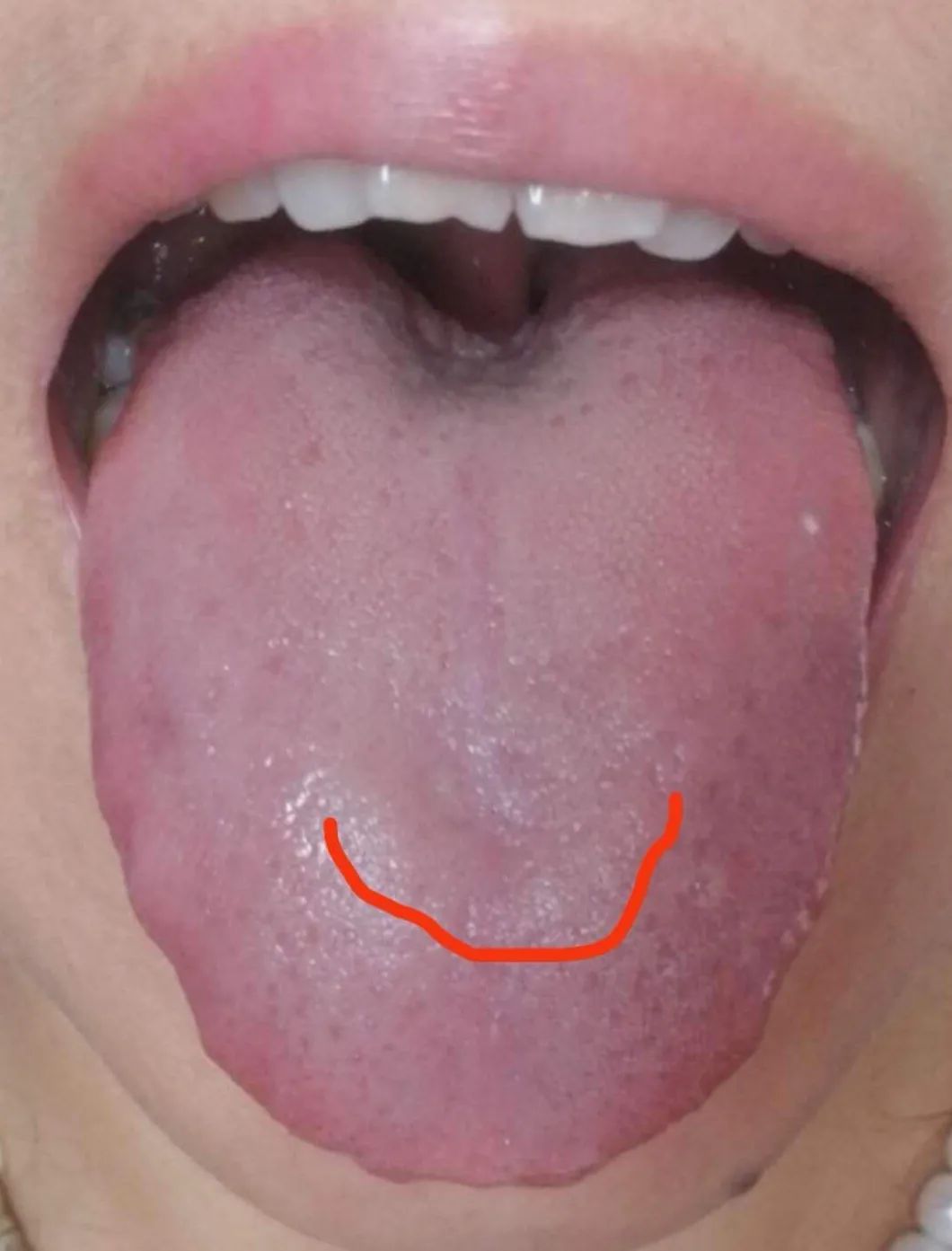 Inheritance of Traditional Chinese Medicine at Zhigu Tang | Basic Theory of TCM Lesson 34 (Tongue Diagnosis: Tongue Color)