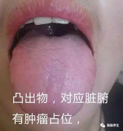 Tongue Diagnosis: A Clear Insight