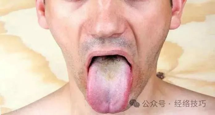 What is Yin Deficiency? A Comprehensive Explanation