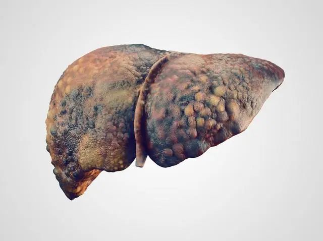 What Causes Liver Fire and Liver Qi Stagnation? Here Are 3 Key Reasons and 4 Habits to Nourish the Liver