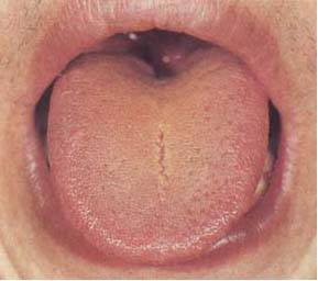 61 High-Definition Tongue Diagnosis Charts: A Visual Reference Collection