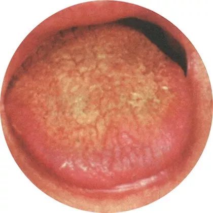 The Most Comprehensive High-Definition Real Tongue Diagnosis: Observing Tongue Patterns to Understand Internal Organs (Collection Edition)