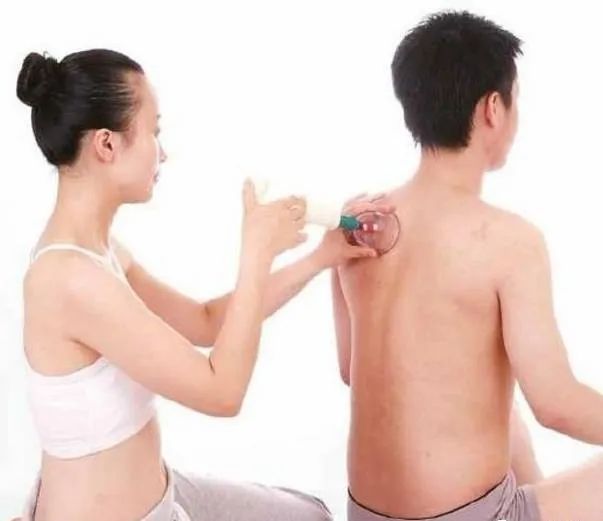 Cupping Therapy in Traditional Chinese Medicine: Meaning, Functions, Contraindications, and Precautions
