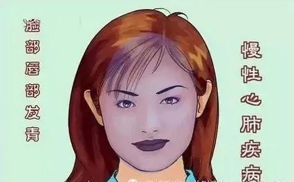 Comprehensive Guide to Facial Diagnosis in Traditional Chinese Medicine (With Images and Explanations)