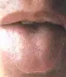 Comprehensive Guide to Tongue Diagnosis: Learn How Your Tongue Reflects Your Health!