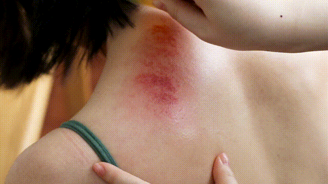 Highly Effective Gua Sha Technique to Remove Chronic Dampness and Toxins from the Body