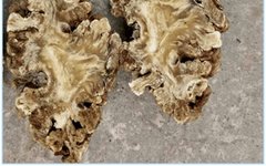Essential Knowledge of Chinese Medicine: Chuanxiong (Ligusticum chuanxiong)