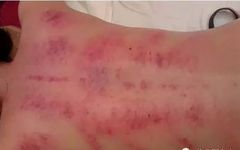 The Most Comprehensive Guide to Gua Sha Knowledge
