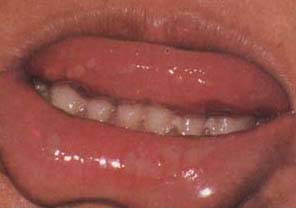 62 High-Definition Tongue Diagnosis Charts with Illustrations (Collector's Edition)