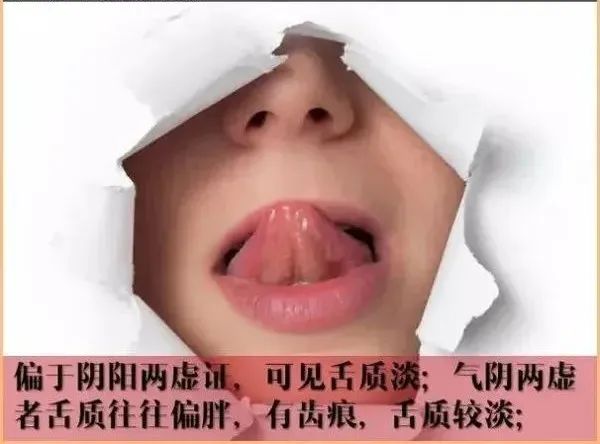 Comprehensive Guide to Observation Diagnosis in TCM: Understanding Shen, Head and Face, Lips, and Tongue Coating