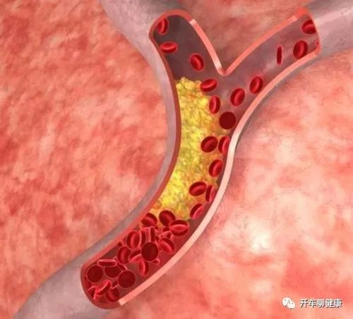 Self-Assessment of Blood Stasis Constitution: Not Only Must Blood Stasis Be Activated and Resolved, But Qi Must Also Be Nourished