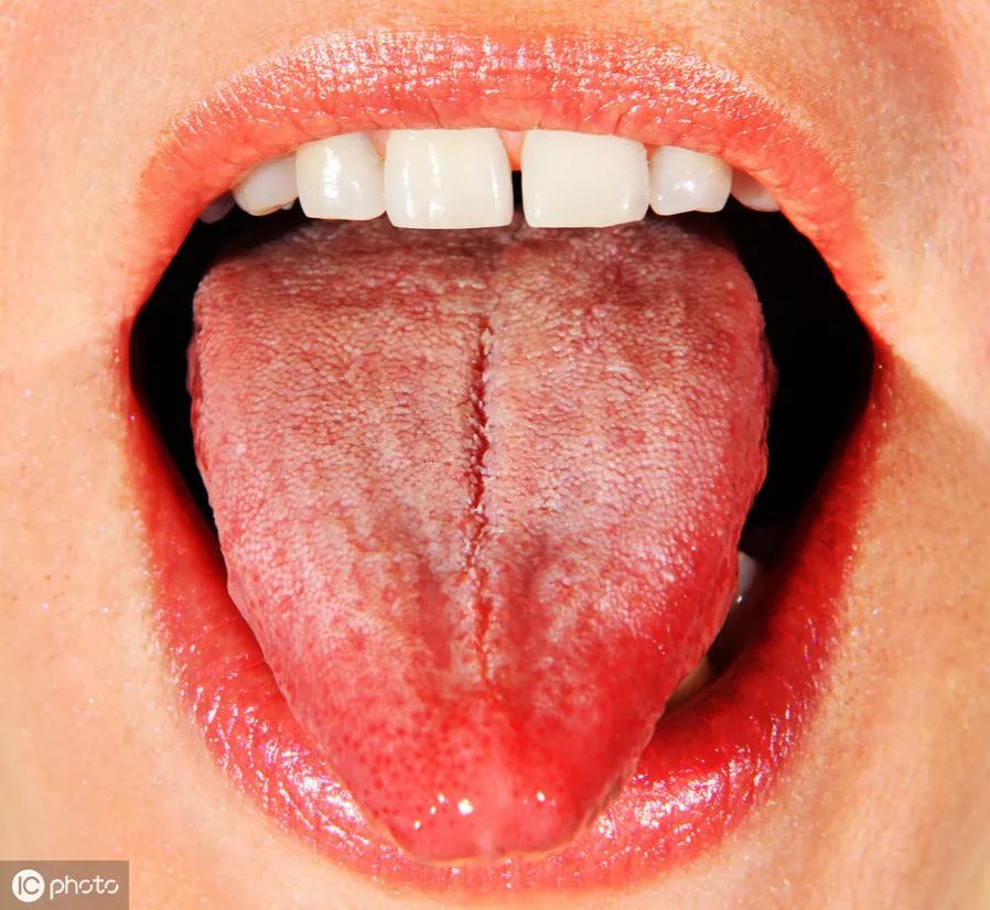 Nine Tongue Signs Indicating Qi Deficiency: Timely Adjustment and Medical Attention Recommended