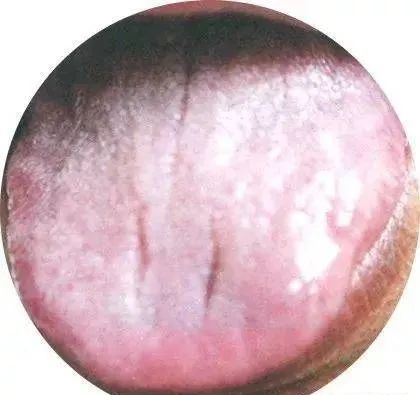 130 High-Definition Tongue Diagnosis Charts (Recommended for Collection)