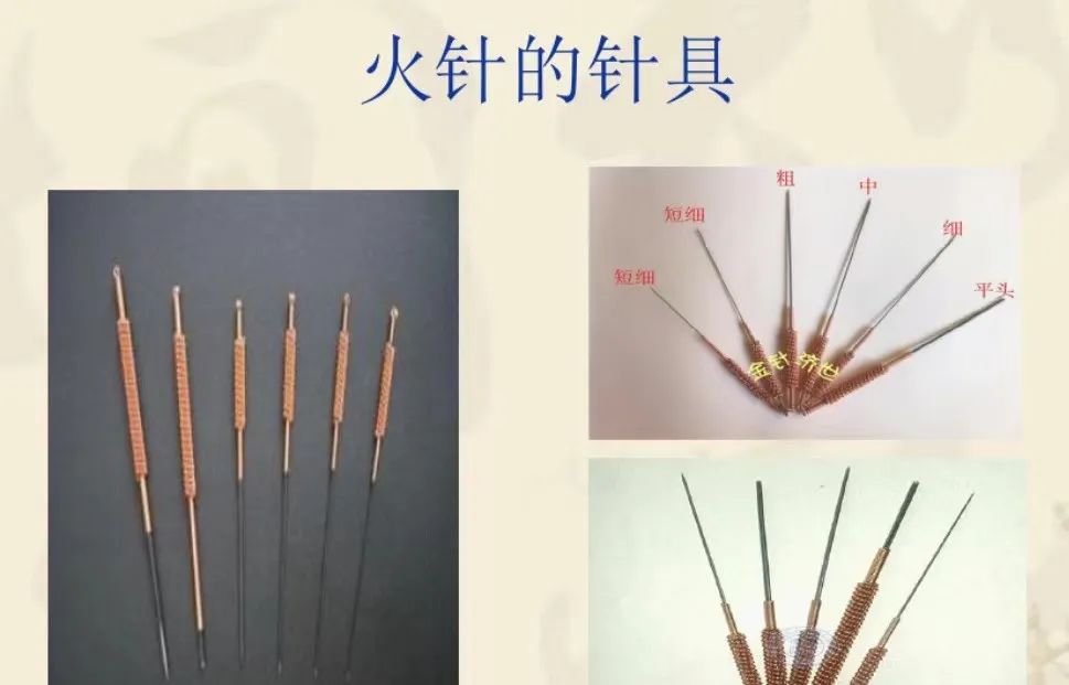 The Remarkable Ancient Essence of TCM: Ten Benefits of Fire Needle Therapy