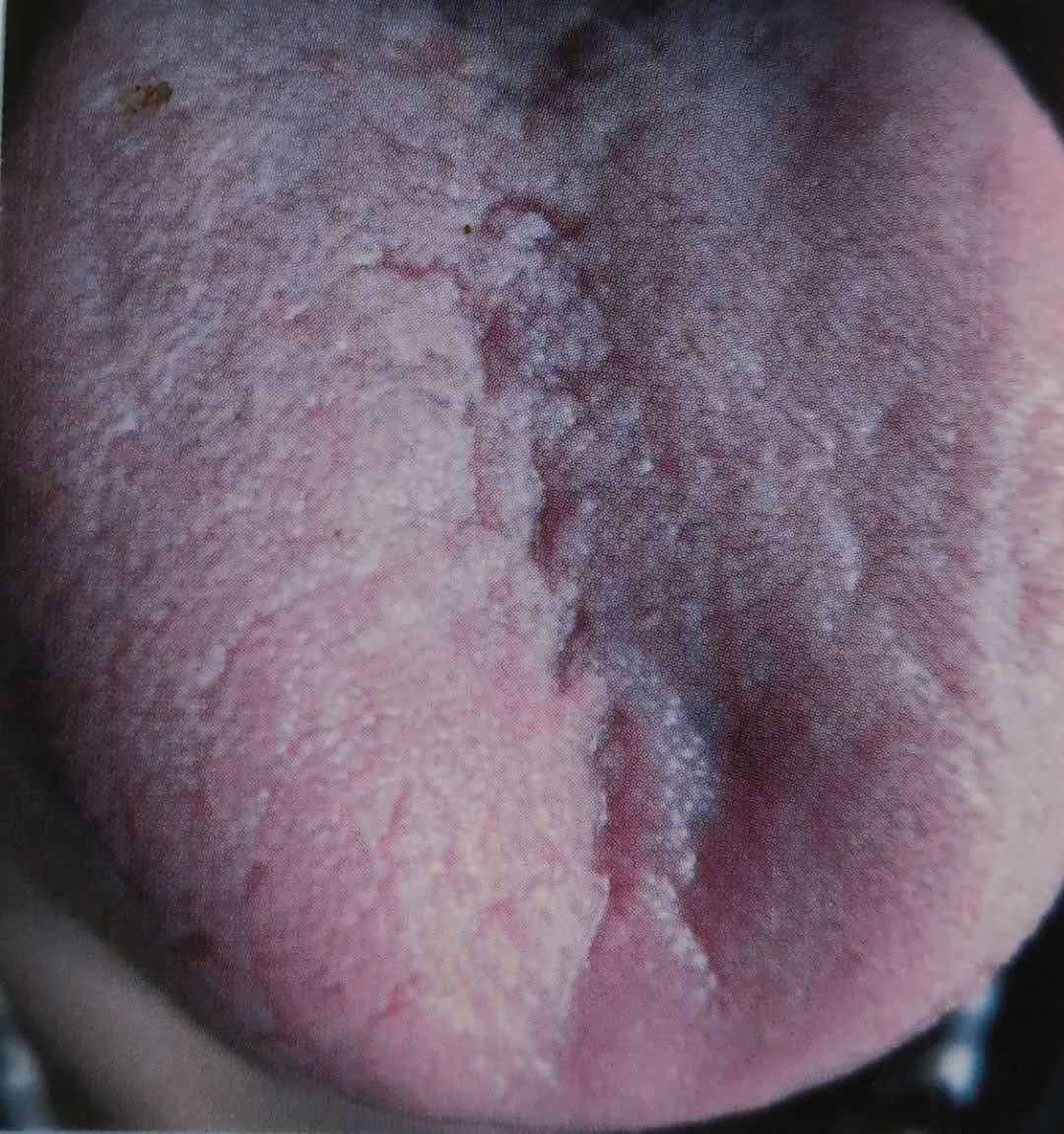 Inheritance of Traditional Chinese Medicine at Zhigu Tang | Basic Theory of TCM Lesson 34 (Tongue Diagnosis: Tongue Color)