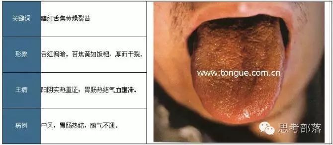 Comprehensive Guide to Tongue Diagnosis (8): 72 Types of Tongue Diagnosis Charts