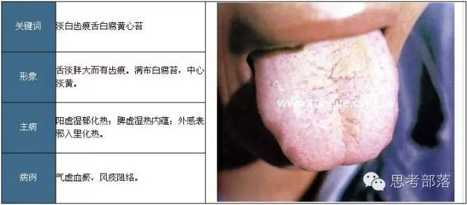 Comprehensive Guide to Tongue Diagnosis (8): 72 Types of Tongue Diagnosis Charts