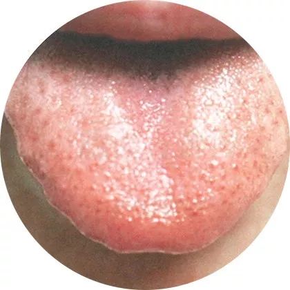 High-Definition Color Atlas of Tongue Diagnosis: Over 100 Types, The Most Comprehensive Ever! (Recommended for Collection)