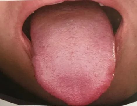 The Health Code Hidden on Your Tongue