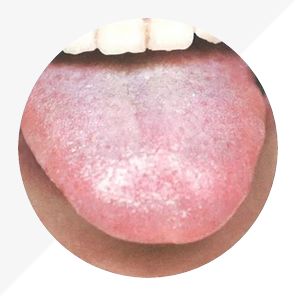 Understanding Tongue Diagnosis in TCM: Insights into Health from Tongue Appearance (Part 2)