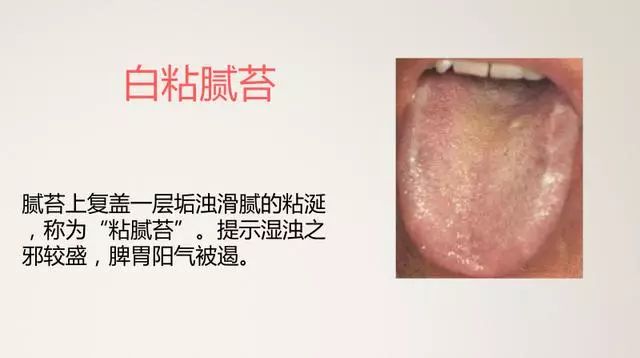 The Most Comprehensive TCM Tongue Diagnosis Atlas: Observe the Tongue, Understand the Whole Body!