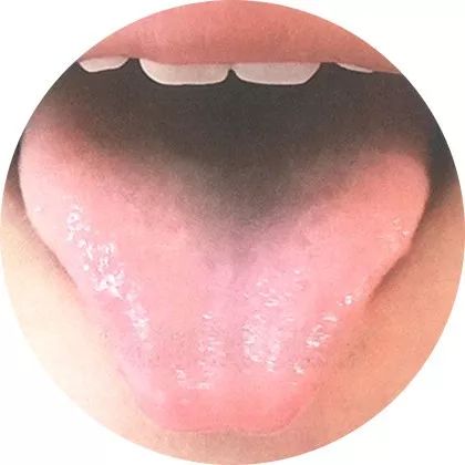 The Most Comprehensive High-Definition Real Tongue Diagnosis: Observing Tongue Patterns to Understand Internal Organs (Collection Edition)