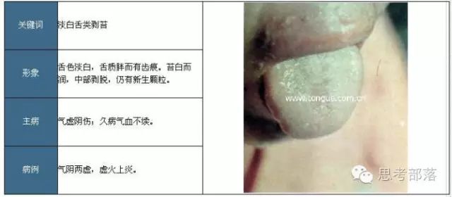 Comprehensive Guide to Tongue Diagnosis (8): 72 Types of Tongue Diagnosis Charts