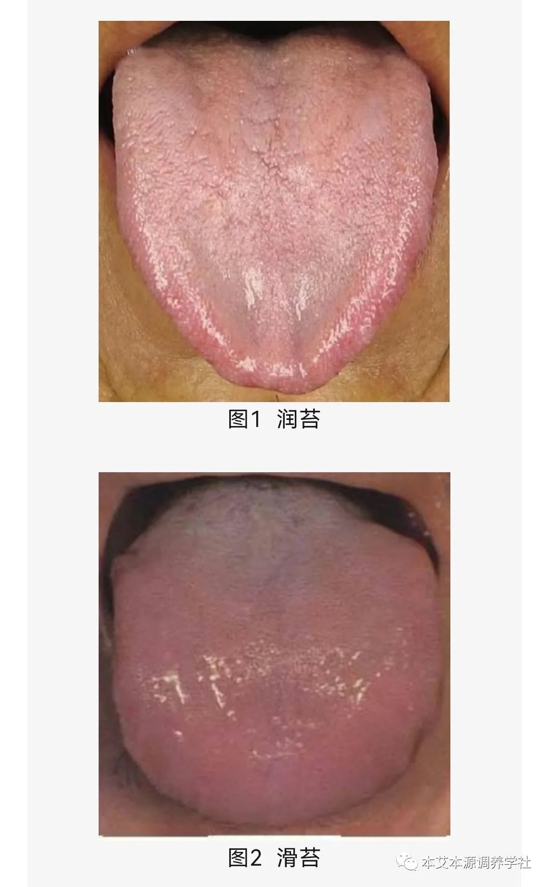 Tongue Diagnosis Series 3: Precise Differentiation of Tongue Coating, Quality, and Shape