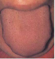 62 High-Definition Tongue Diagnosis Charts with Illustrations (Collector's Edition)