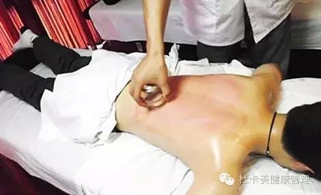 The Significance of Cupping Therapy
