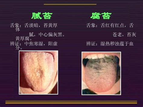 A Comprehensive Guide to Tongue Diagnosis in Traditional Chinese Medicine