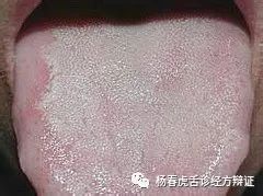 Foundations of Traditional Chinese Medicine: Phlegm-Dampness